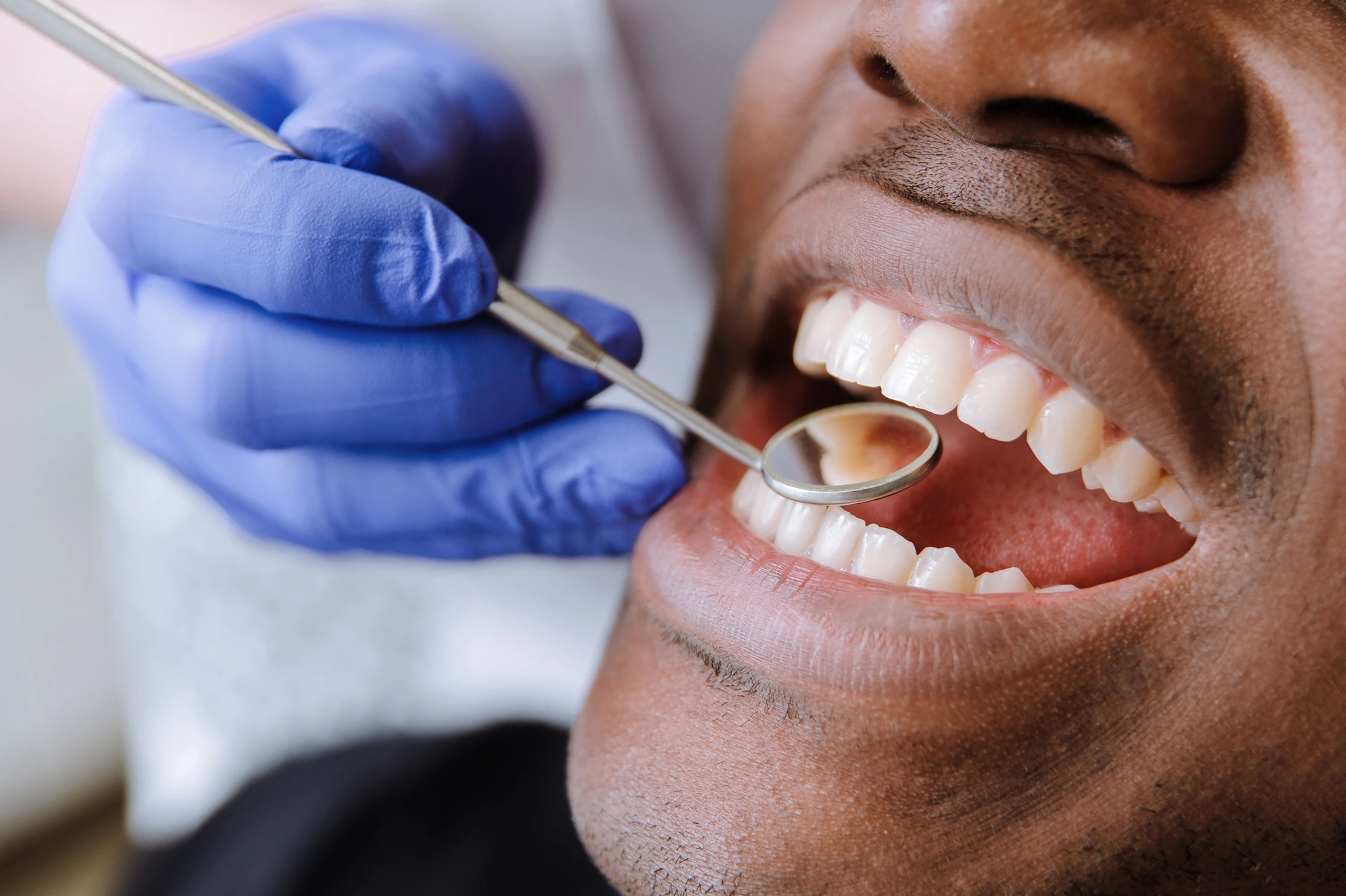 understanding-and-treating-tooth-infections-a-comprehensive-guide