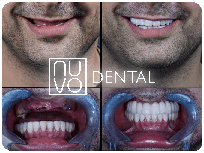 A collage of a man's teeth