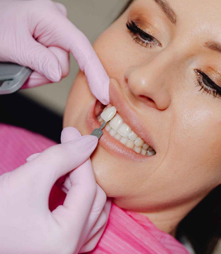 Benefits of Dental Implants