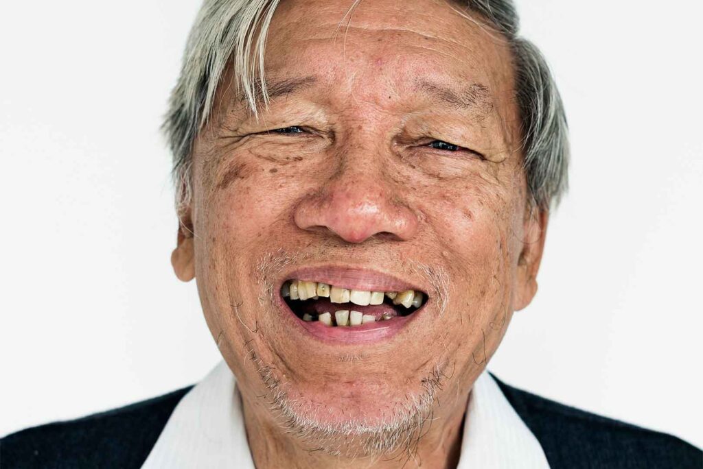 Common-Dental-Problems-in-Old-Age