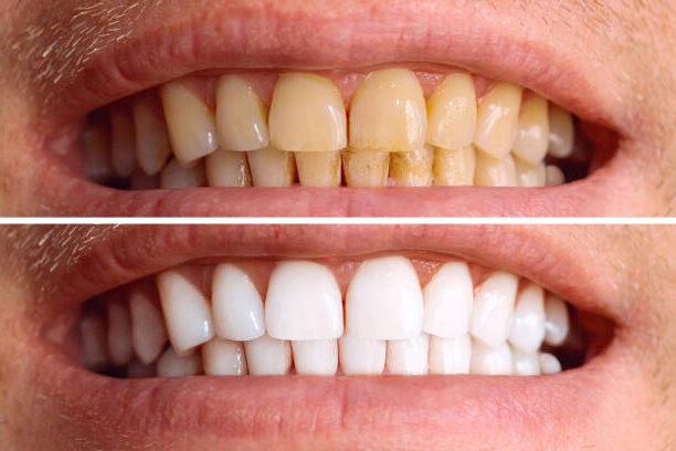 Who Can Benefit from Cosmetics Dental in 2025