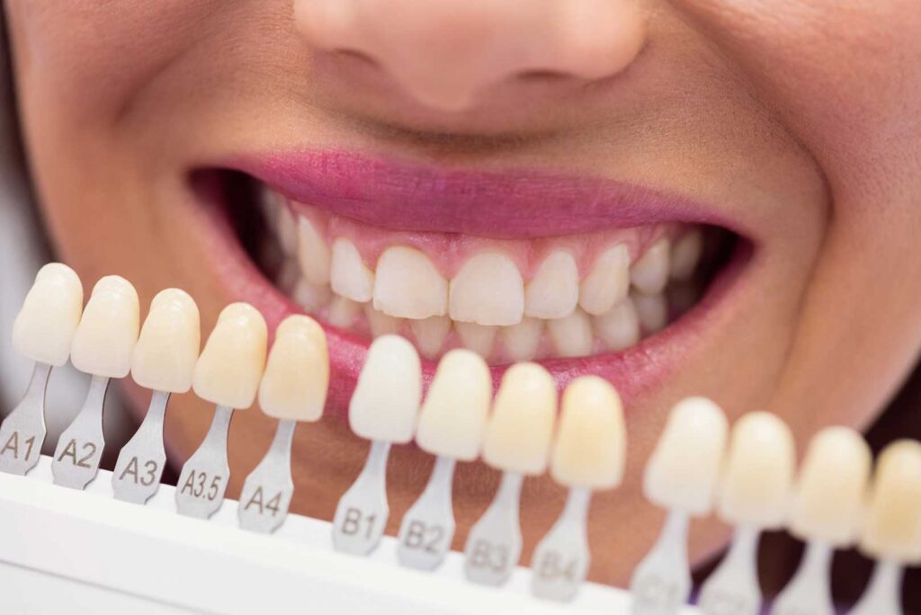 The Best Dental Crowns in 2025