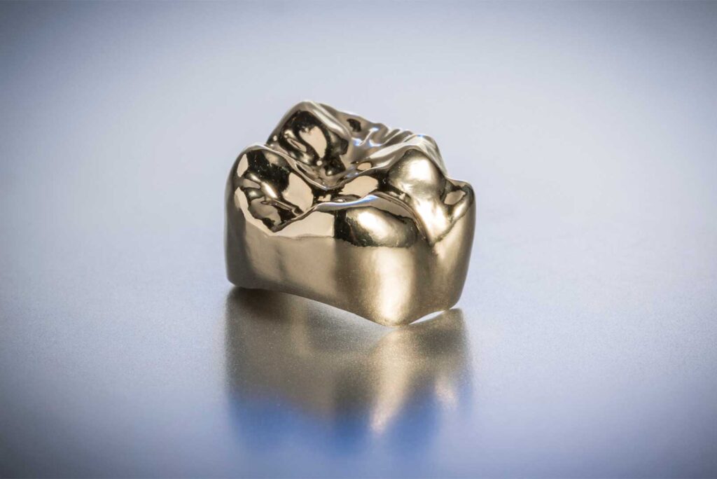Materials Used in Dental Crowns
