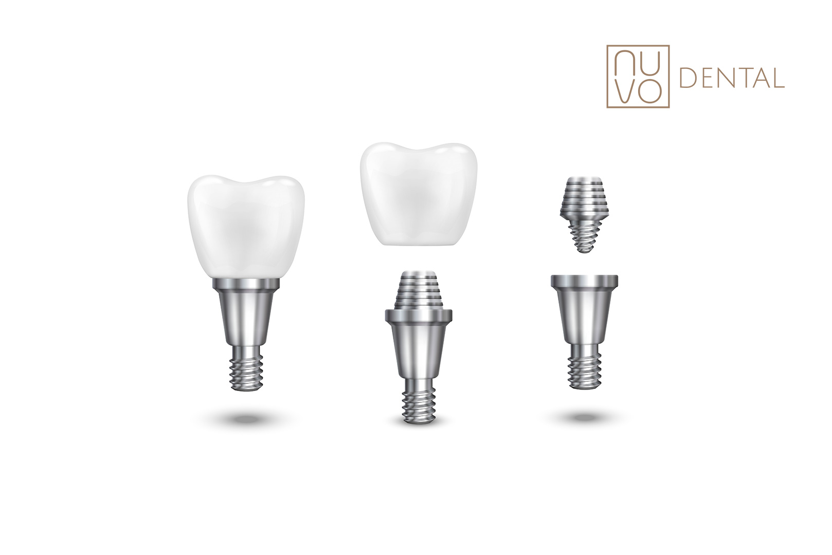 Does Getting a Dental Implant Hurt