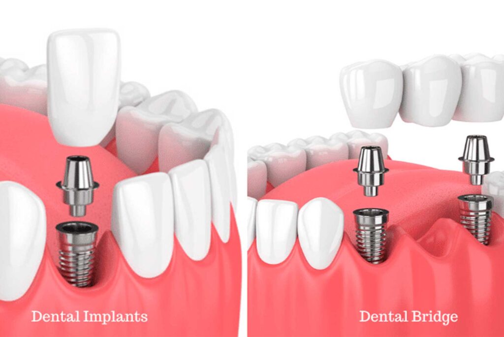 Understanding Each Option