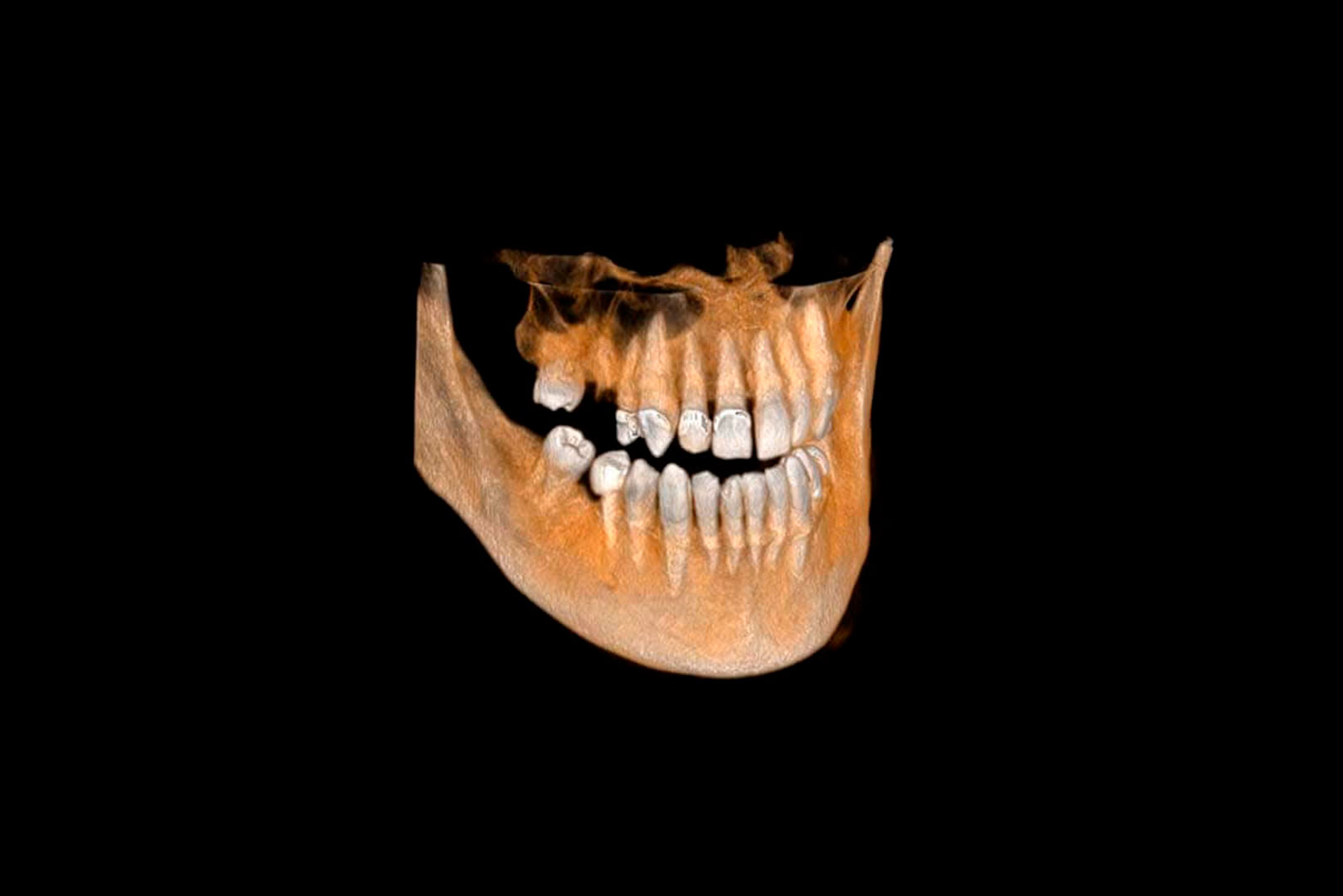 What is CBCT? A Complete Guide to 3D Dental Imaging at Nuvo Dental ...