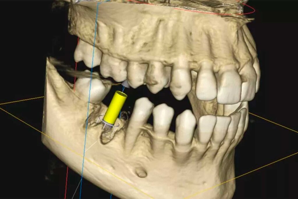 What is CBCT? A Complete Guide to 3D Dental Imaging at Nuvo Dental ...