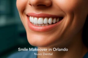 Smile Makeover in Orlando
