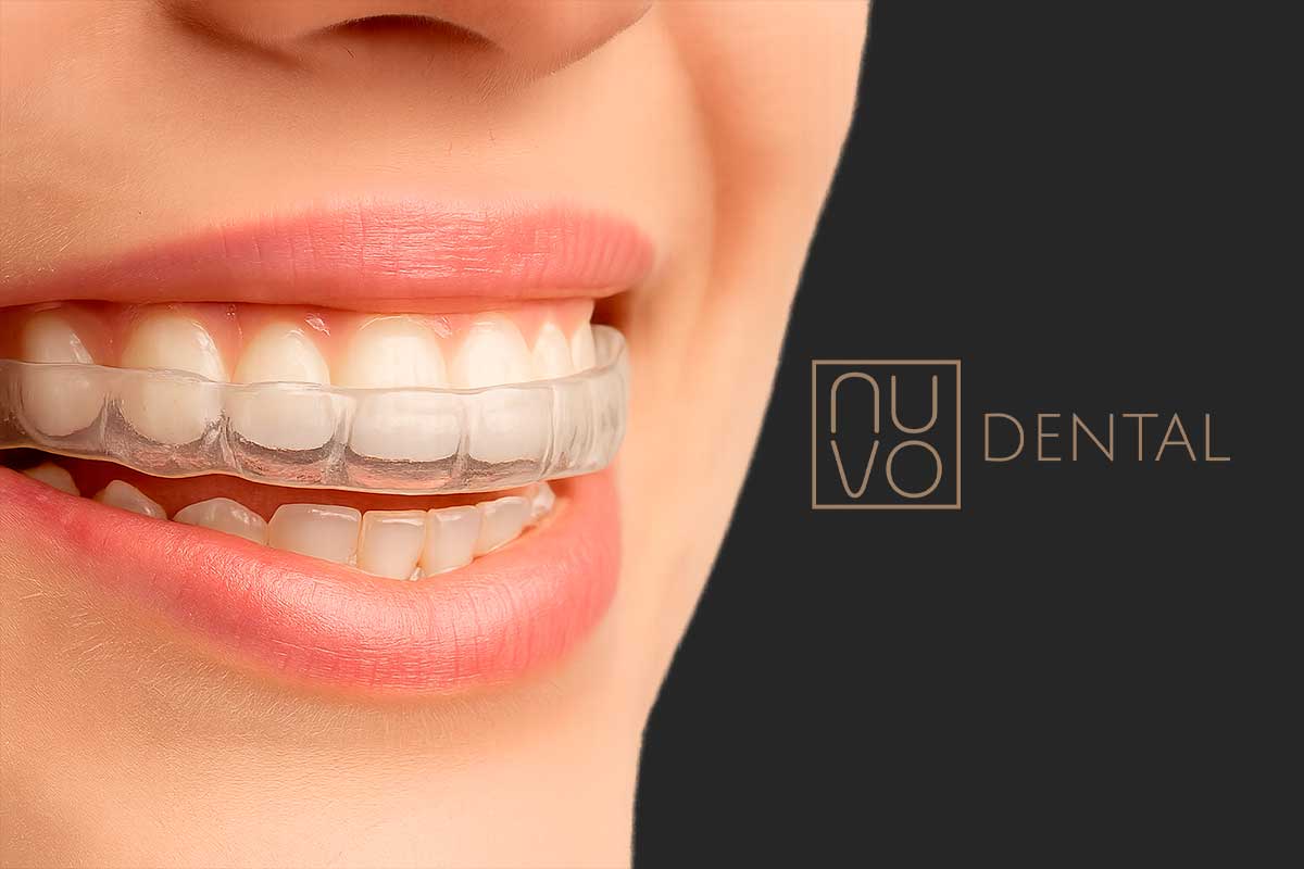 Cómo Proteger tu Sonrisa