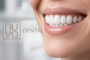 Professional Teeth Whitening