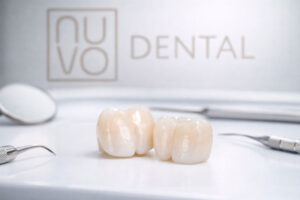 Coronas-Dentales-en-Florida