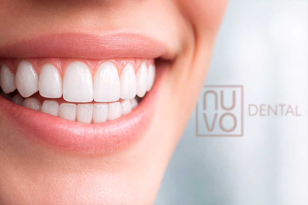 How-to-Protect-Your-Smile