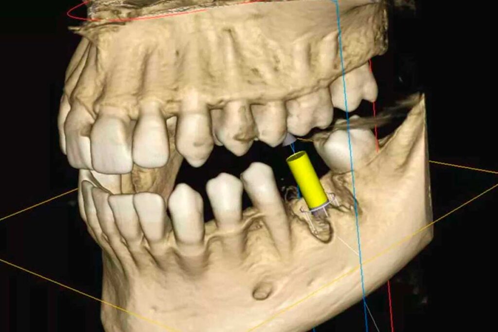 What Is CBCT Dental Imaging