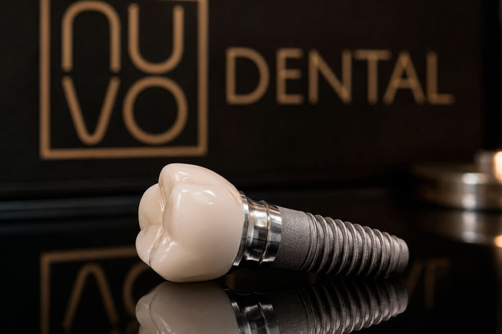 I Need Dental Implants Near Me