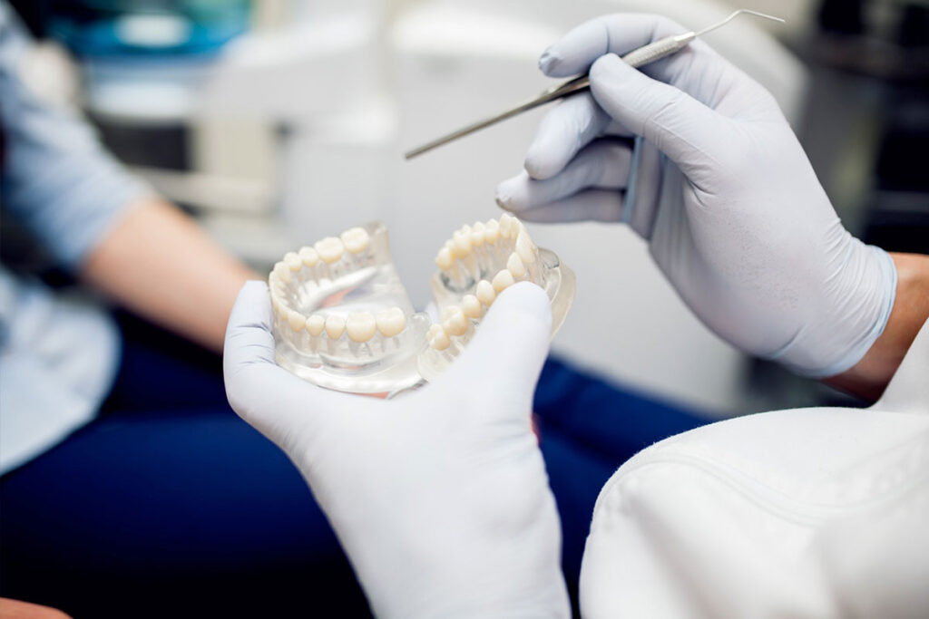 Can a Crack Become Too Severe for a Dental Crown