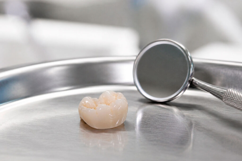 Cracked Tooth Repair in Orlando
