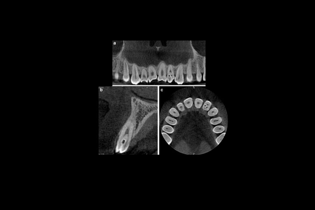 Qué información puede aportar una imagen dental 3D