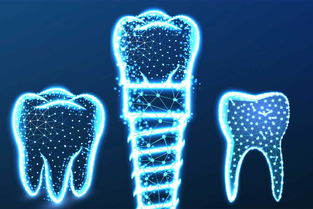 Restorative-Planning-Goes-Beyond-Replacing-a-Missing-Tooth