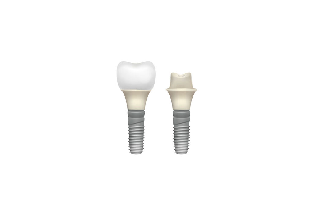 What-Defines-a-High-Quality-Implant-Center