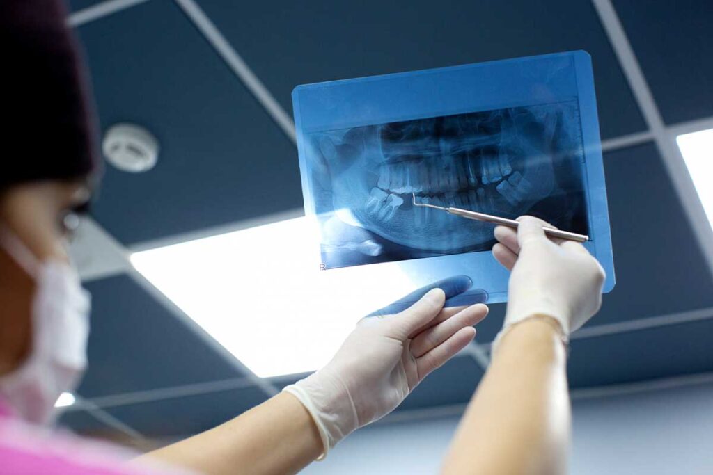 What Dentists Evaluate When Designing a Smile