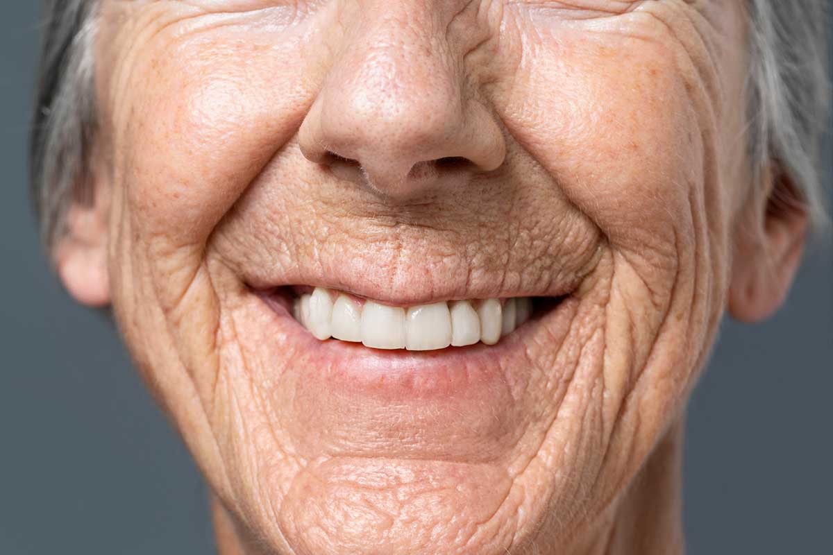 Can Worn Teeth Be Made to Look Longer Again